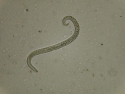 L1 larve af A. vasorum